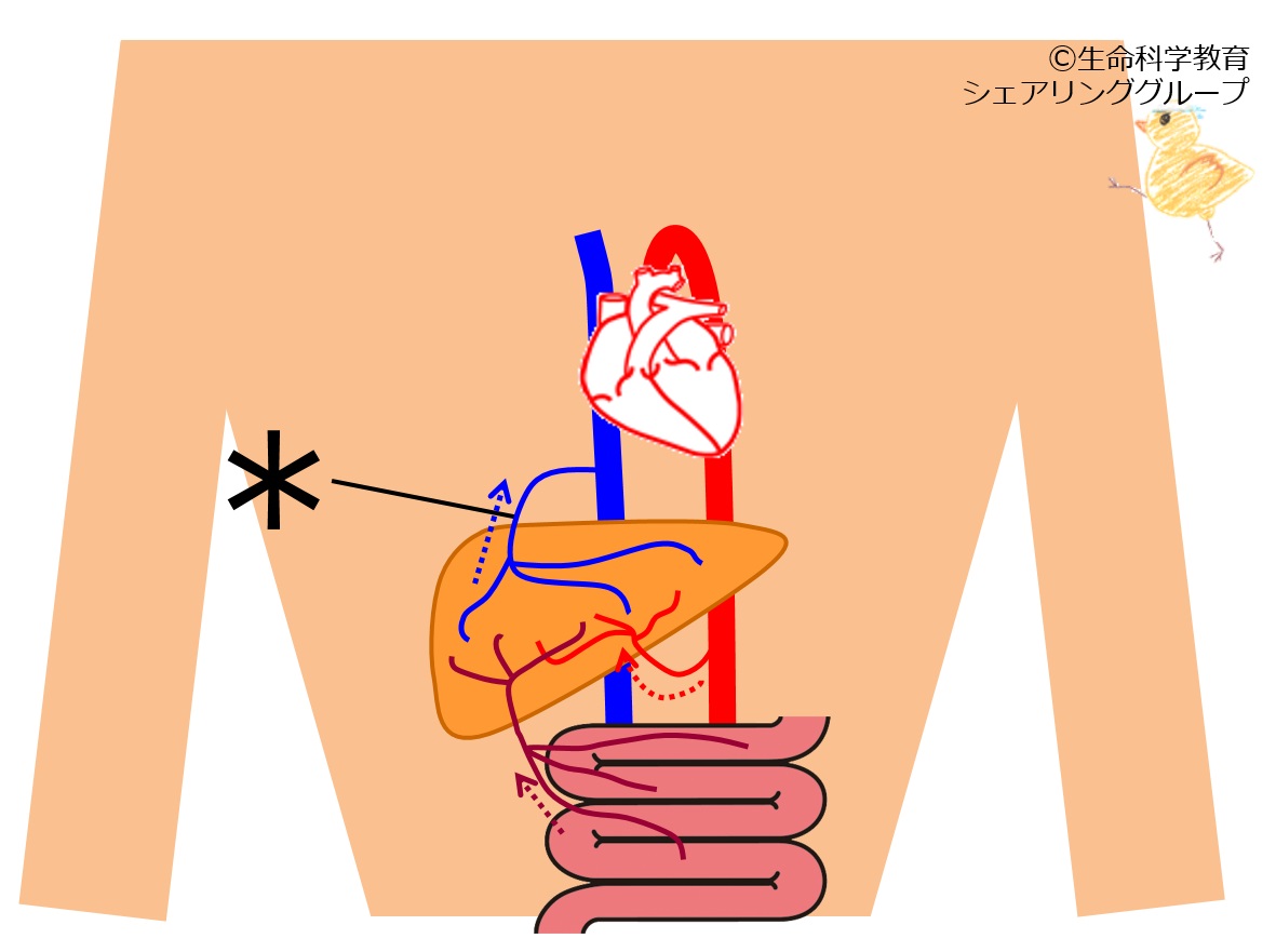./images/肝臓血管_クイズ.jpg