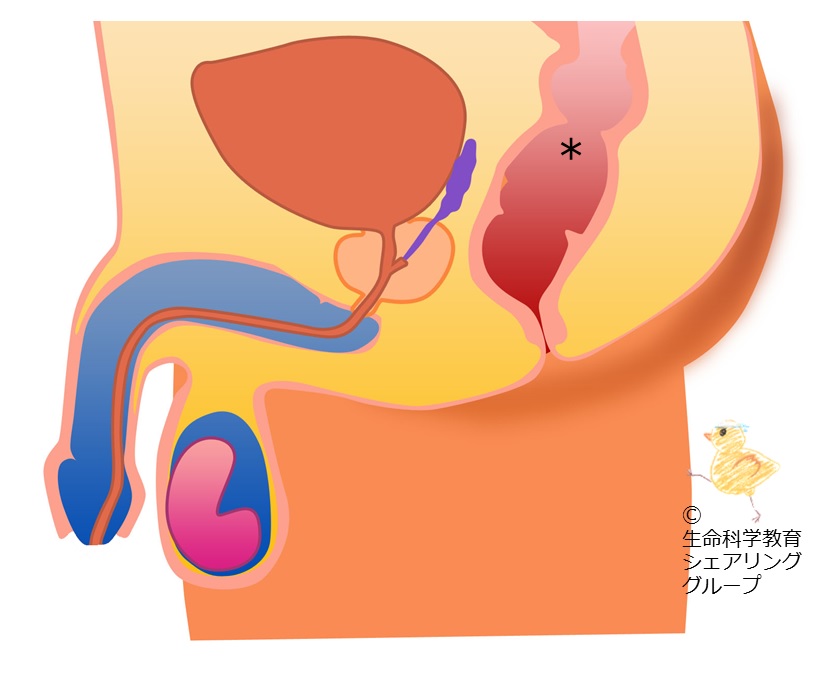 ./images/クイズ_直腸.jpg