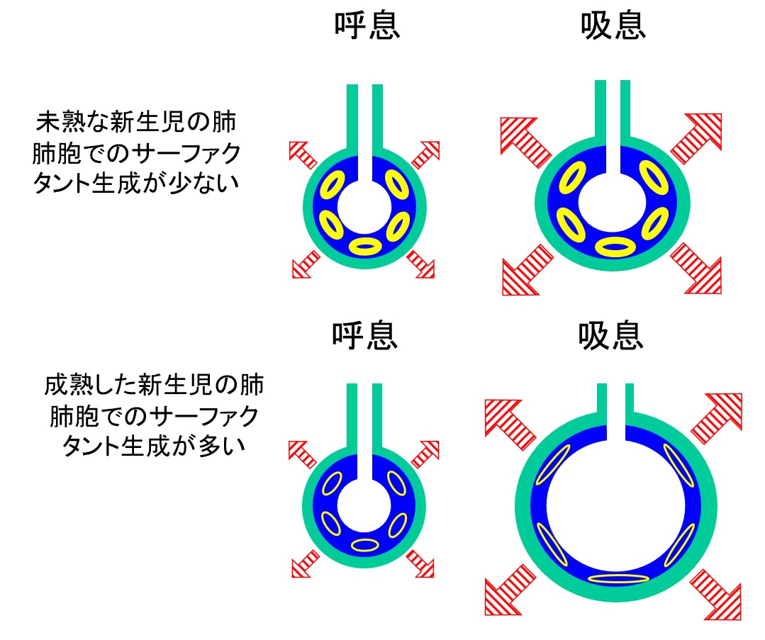 新生児肺.jpg